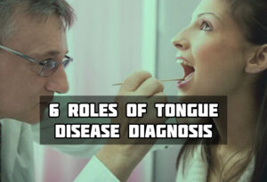 6 Roles Of The Tongue In Disease Diagnosis