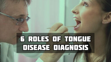 6 Roles Of The Tongue In Disease Diagnosis